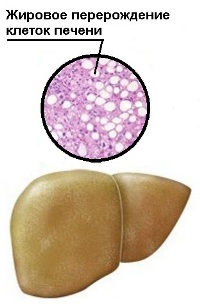 Izgled masne jetre